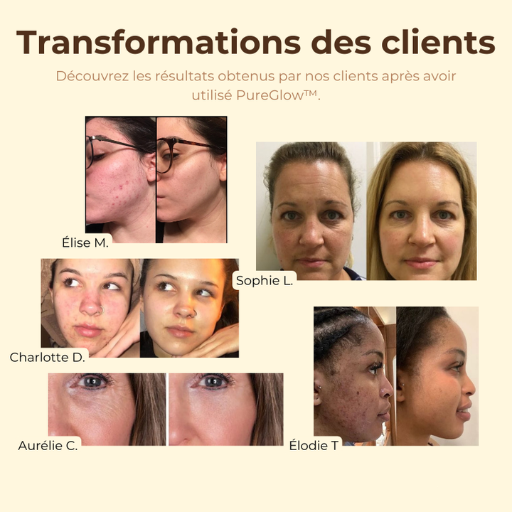 PureGlow™ Masque au Thé Noir