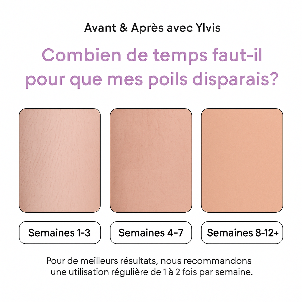 Ylvis™ Épilateur Laser - Facile & à Domicile